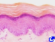 epitelio estratificado plano queratinizado