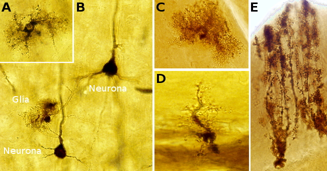 Golgi impregantion