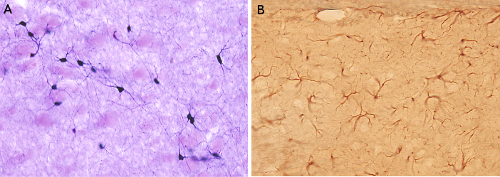 Astrocitos y neuronas