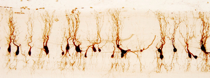 Neuronas