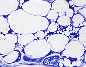 White adipocytes