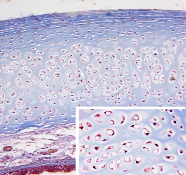 Hyalin cartilage