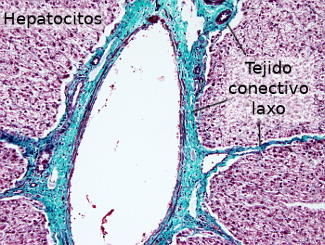 Tejido conectivo laxo en el hígado