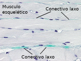 Tejido conectivo laxo en el músculo