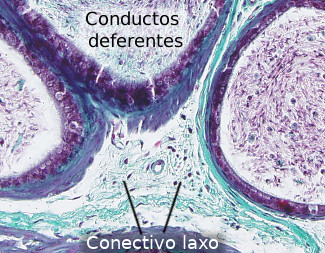 Tejido conectivo laxo en el testículo