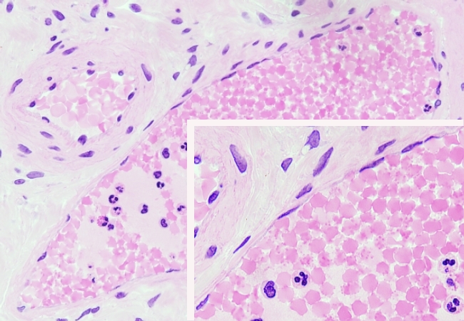  Simple squamous epithelium