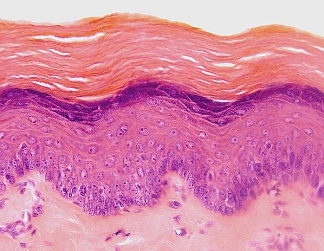 Keratinized stratified squamous epithelium