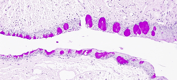 Intraepithelial gland