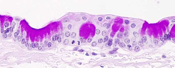 Glándula intraepitelial