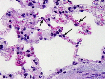  Alveolos pulmonares