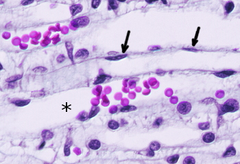 Loop of Henle