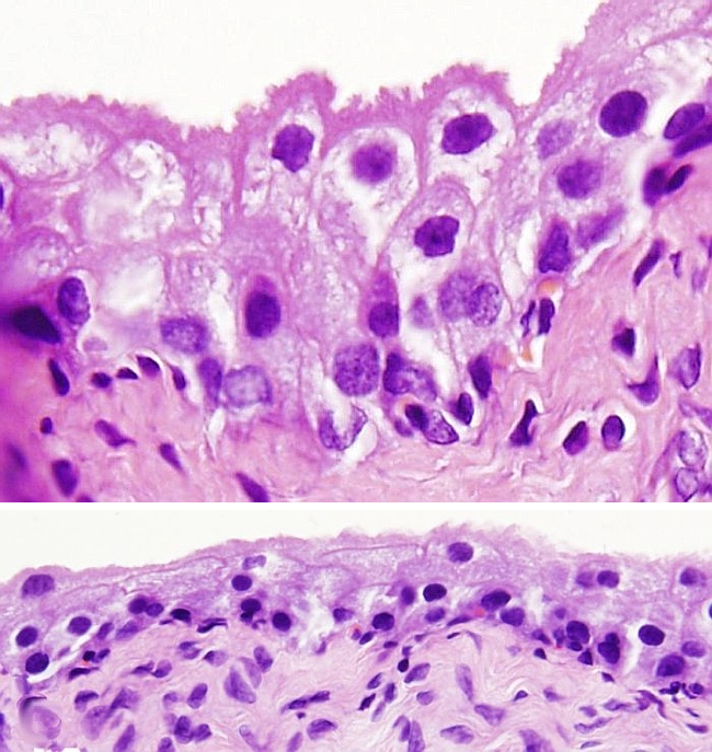 Epithelium: transitional