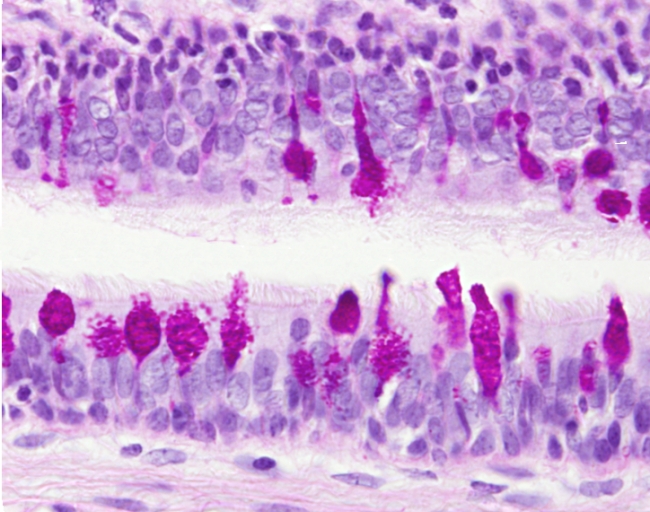 Intraepithelial glandular cells