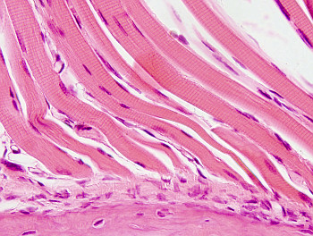 Striated skeletal muscle cells