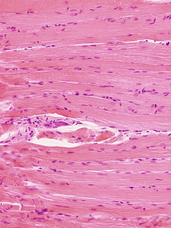 Striated skeletal muscle cells