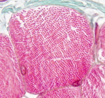 Striated skeletal muscle cells