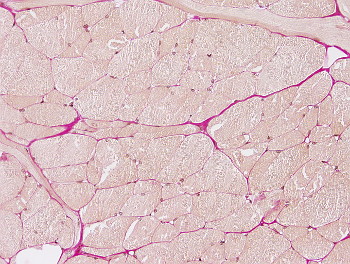 Striated skeletal muscle