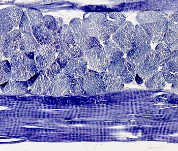 Striated skeletal muscle