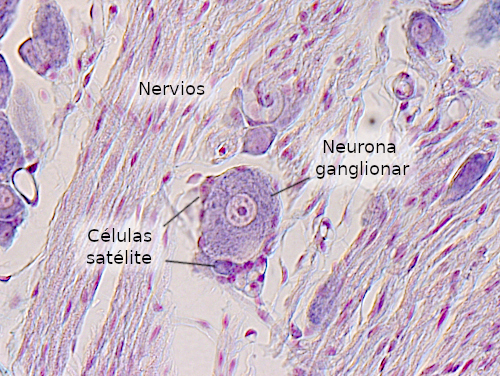 Neurona ganglionar