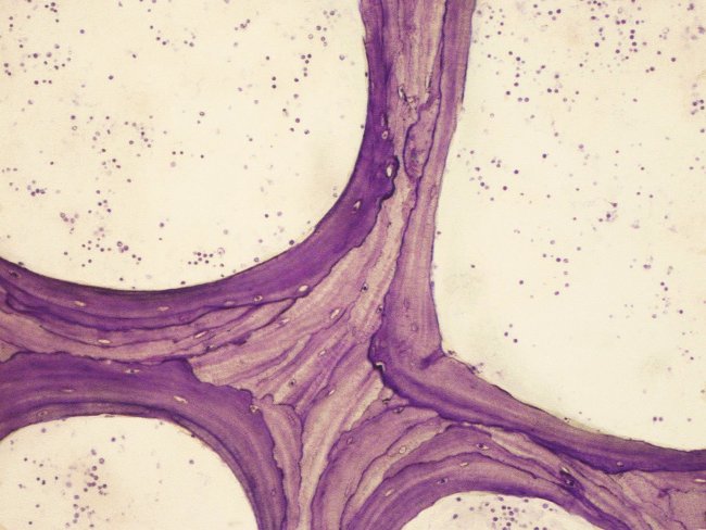 Hueso trabecular