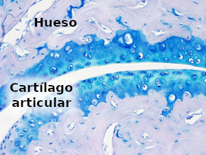 Cartílago articular