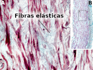 Fibras elásticas