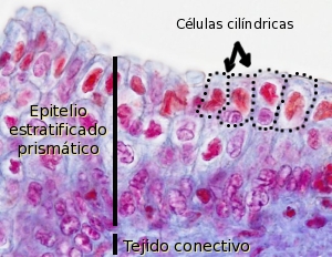 epitelio  estratificado prismático