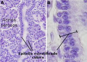 epitelio  stratificado cúbico