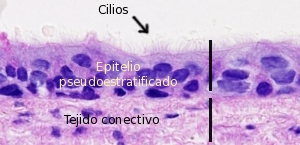 Epitelio pseudoestratificado