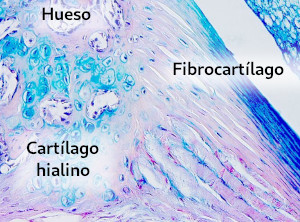 Fibrocartílago