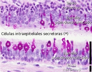 Glándula intraepitelial