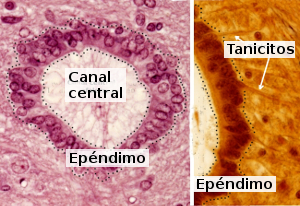 Epéndimo